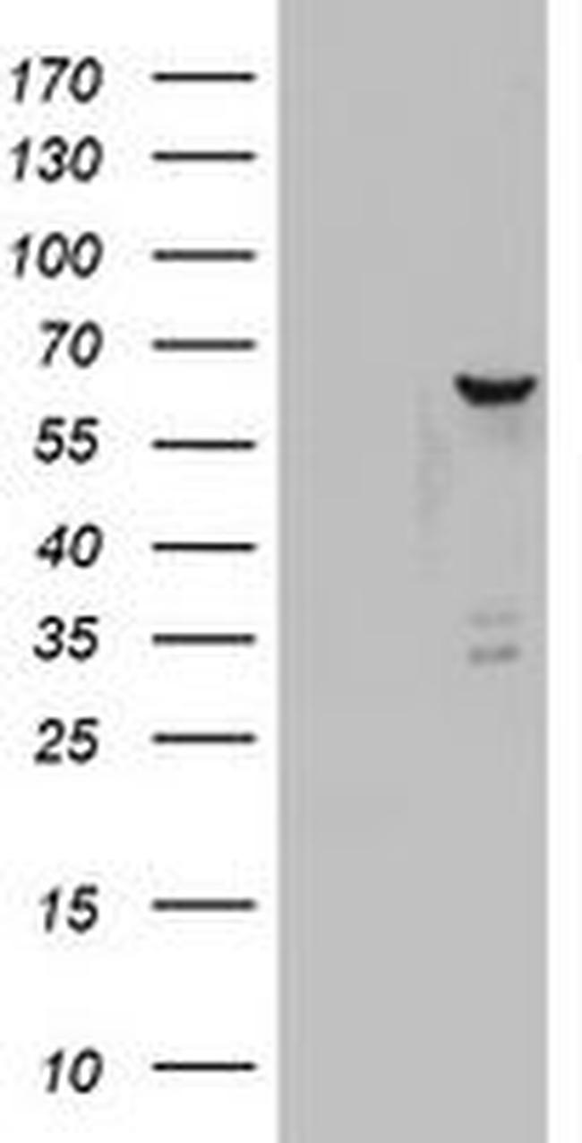 DDX56 Antibody in Western Blot (WB)