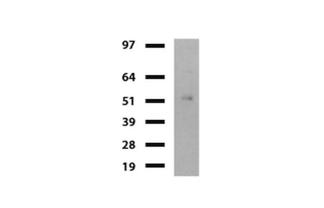 DDX56 Antibody in Western Blot (WB)