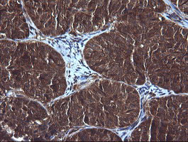 DDX58 Antibody in Immunohistochemistry (Paraffin) (IHC (P))