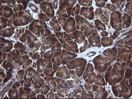 DDX58 Antibody in Immunohistochemistry (Paraffin) (IHC (P))