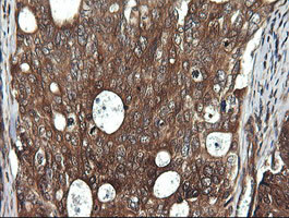 DDX58 Antibody in Immunohistochemistry (Paraffin) (IHC (P))