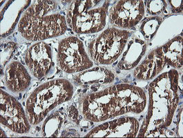 DDX58 Antibody in Immunohistochemistry (Paraffin) (IHC (P))