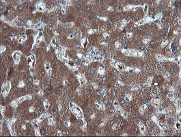 DDX58 Antibody in Immunohistochemistry (Paraffin) (IHC (P))