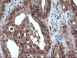 DDX58 Antibody in Immunohistochemistry (Paraffin) (IHC (P))