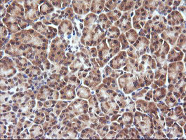 DDX58 Antibody in Immunohistochemistry (Paraffin) (IHC (P))