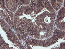 DDX58 Antibody in Immunohistochemistry (Paraffin) (IHC (P))