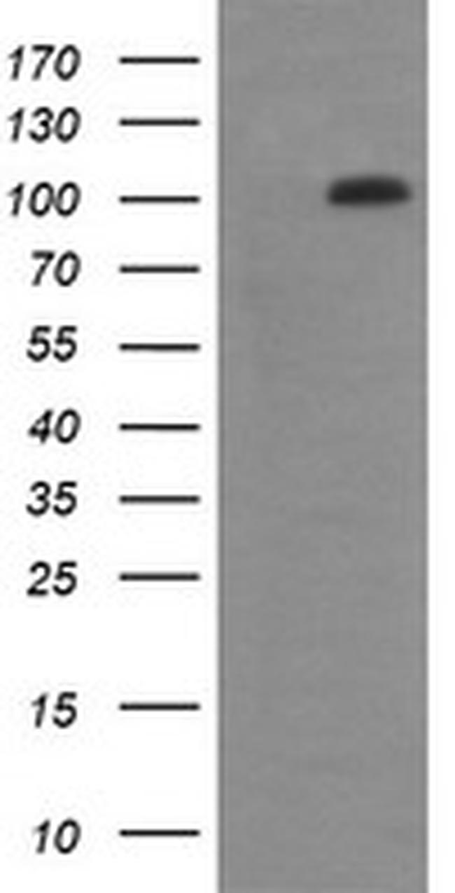 DDX58 Antibody in Western Blot (WB)