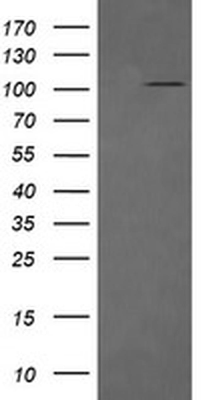 DDX58 Antibody in Western Blot (WB)