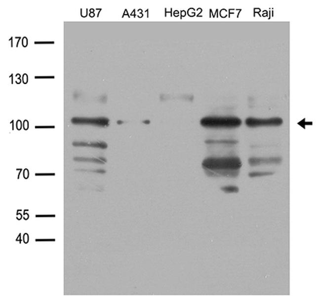 DDX58 Antibody in Western Blot (WB)