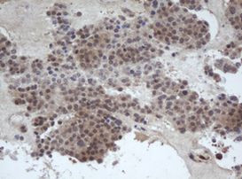 DDX59 Antibody in Immunohistochemistry (Paraffin) (IHC (P))