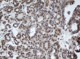 DDX59 Antibody in Immunohistochemistry (Paraffin) (IHC (P))