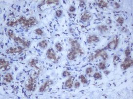 DDX59 Antibody in Immunohistochemistry (Paraffin) (IHC (P))