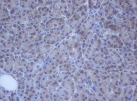 DDX59 Antibody in Immunohistochemistry (Paraffin) (IHC (P))