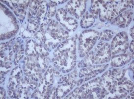 DDX59 Antibody in Immunohistochemistry (Paraffin) (IHC (P))