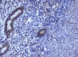 DDX59 Antibody in Immunohistochemistry (Paraffin) (IHC (P))