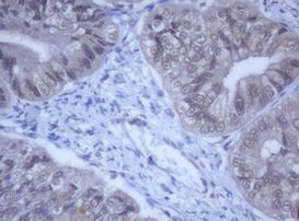 DDX59 Antibody in Immunohistochemistry (Paraffin) (IHC (P))