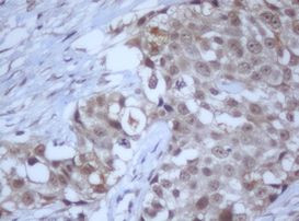 DDX59 Antibody in Immunohistochemistry (Paraffin) (IHC (P))