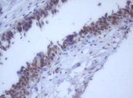 DDX59 Antibody in Immunohistochemistry (Paraffin) (IHC (P))