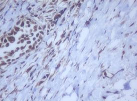 DDX59 Antibody in Immunohistochemistry (Paraffin) (IHC (P))