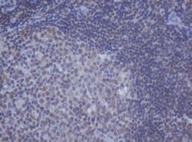 DDX59 Antibody in Immunohistochemistry (Paraffin) (IHC (P))