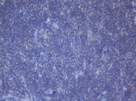 DDX59 Antibody in Immunohistochemistry (Paraffin) (IHC (P))