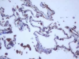 DDX59 Antibody in Immunohistochemistry (Paraffin) (IHC (P))