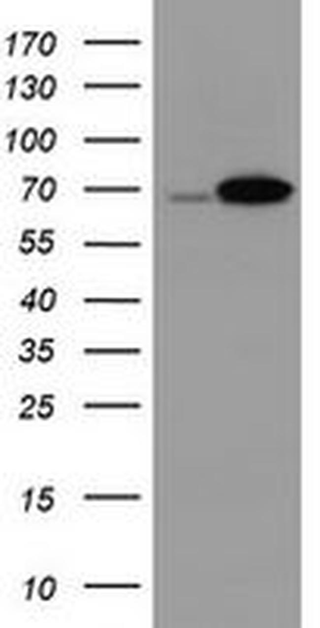 DDX59 Antibody in Western Blot (WB)