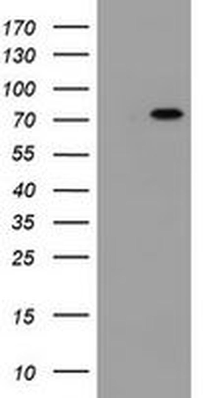 DDX59 Antibody in Western Blot (WB)