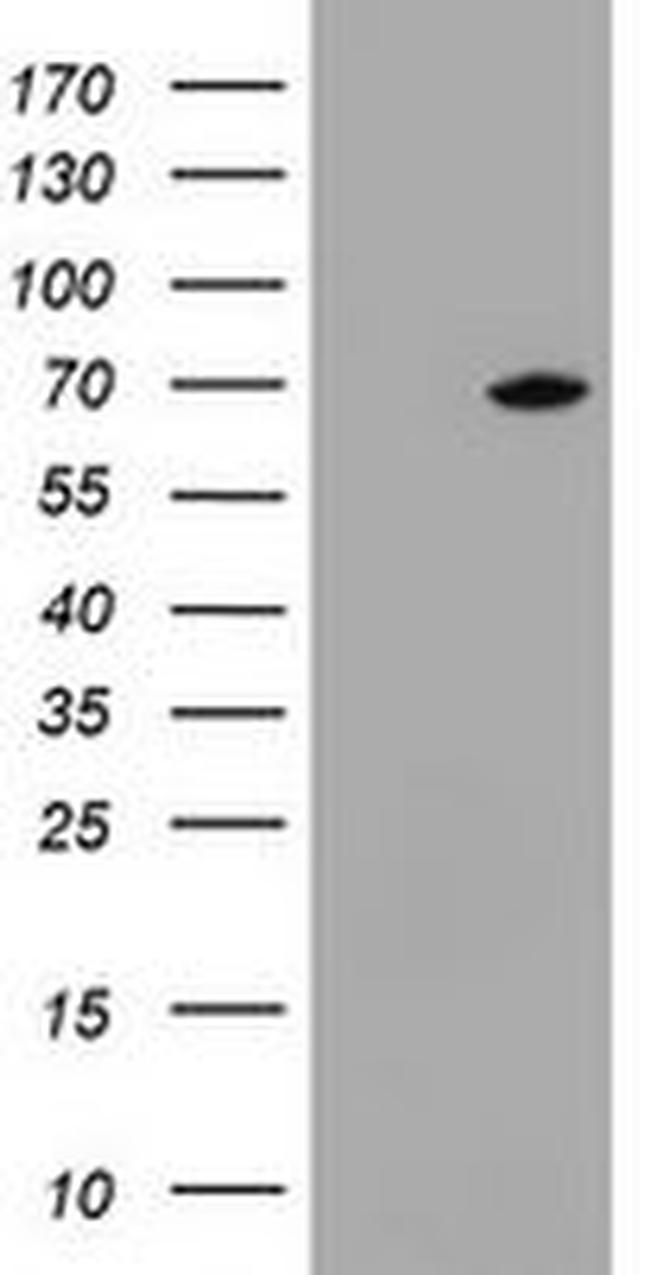 DDX59 Antibody in Western Blot (WB)