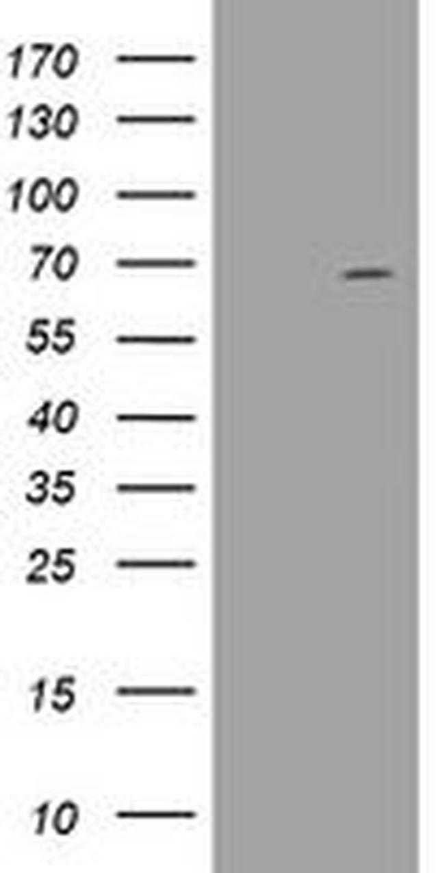 DDX59 Antibody in Western Blot (WB)