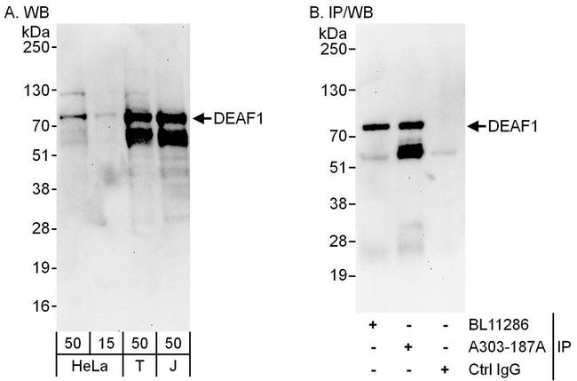 DEAF1 Antibody in Western Blot (WB)