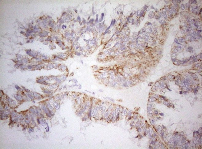 DECR1 Antibody in Immunohistochemistry (Paraffin) (IHC (P))