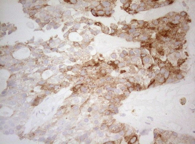 DECR1 Antibody in Immunohistochemistry (Paraffin) (IHC (P))