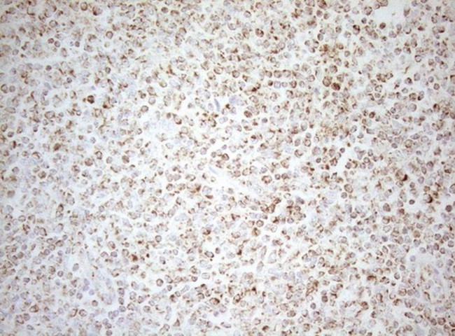 DECR1 Antibody in Immunohistochemistry (Paraffin) (IHC (P))