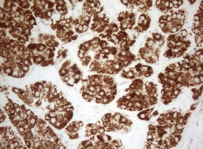 DECR1 Antibody in Immunohistochemistry (Paraffin) (IHC (P))