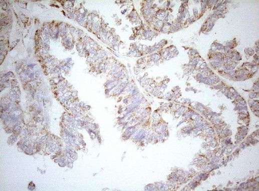 DECR1 Antibody in Immunohistochemistry (Paraffin) (IHC (P))