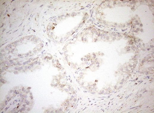 DECR1 Antibody in Immunohistochemistry (Paraffin) (IHC (P))