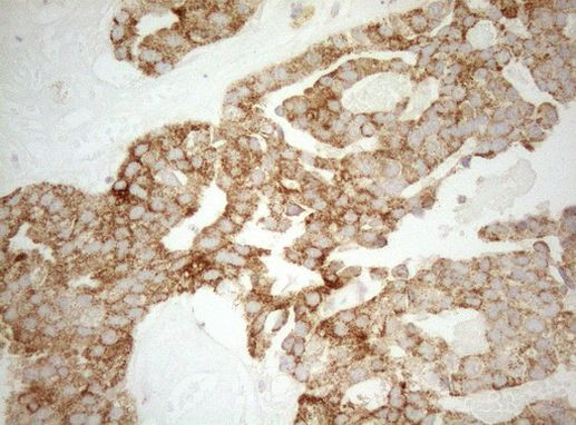 DECR1 Antibody in Immunohistochemistry (Paraffin) (IHC (P))