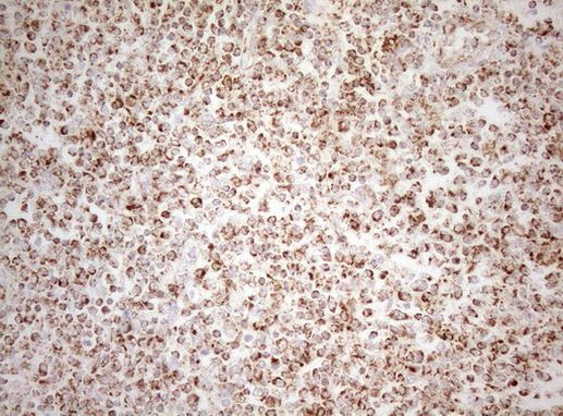 DECR1 Antibody in Immunohistochemistry (Paraffin) (IHC (P))