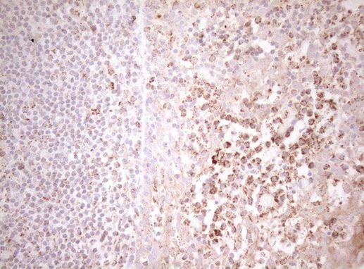 DECR1 Antibody in Immunohistochemistry (Paraffin) (IHC (P))