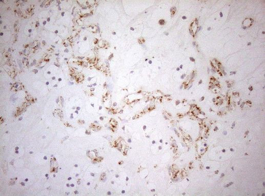 DECR1 Antibody in Immunohistochemistry (Paraffin) (IHC (P))