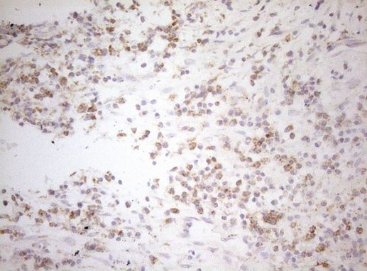 DECR1 Antibody in Immunohistochemistry (Paraffin) (IHC (P))