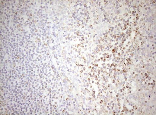 DECR1 Antibody in Immunohistochemistry (Paraffin) (IHC (P))