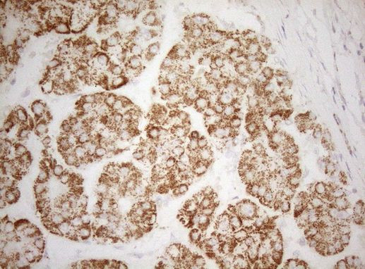 DECR1 Antibody in Immunohistochemistry (Paraffin) (IHC (P))