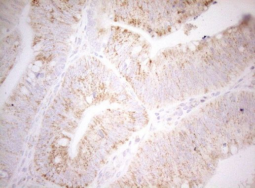 DECR1 Antibody in Immunohistochemistry (Paraffin) (IHC (P))