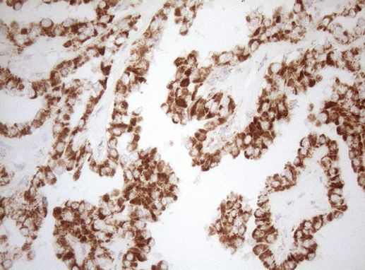 DECR1 Antibody in Immunohistochemistry (Paraffin) (IHC (P))