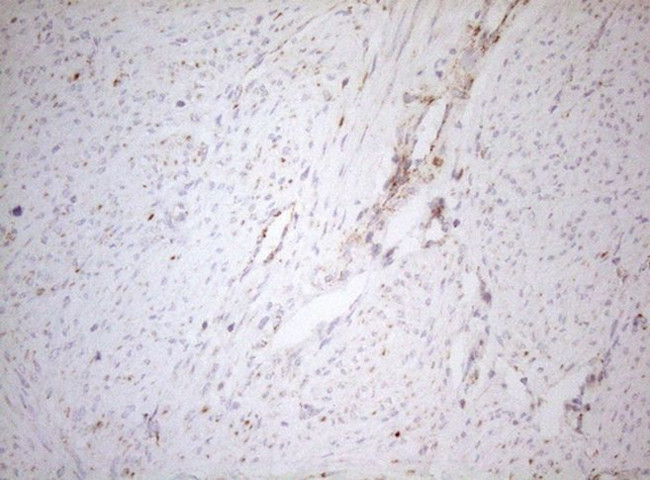 DECR1 Antibody in Immunohistochemistry (Paraffin) (IHC (P))