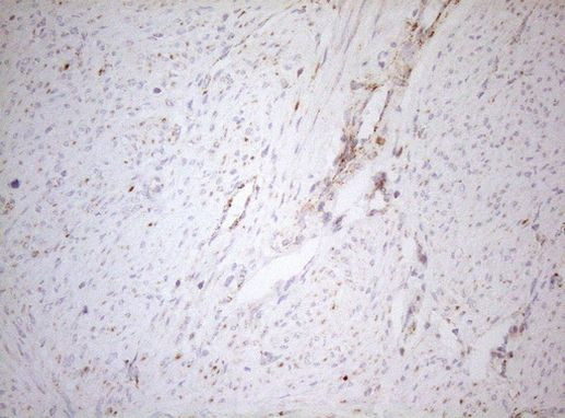 DECR1 Antibody in Immunohistochemistry (Paraffin) (IHC (P))