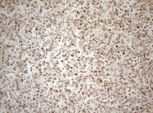 DECR1 Antibody in Immunohistochemistry (Paraffin) (IHC (P))