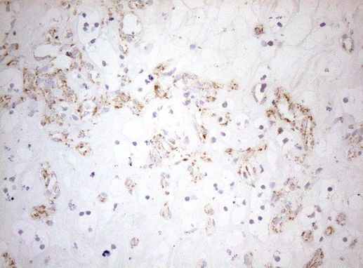 DECR1 Antibody in Immunohistochemistry (Paraffin) (IHC (P))